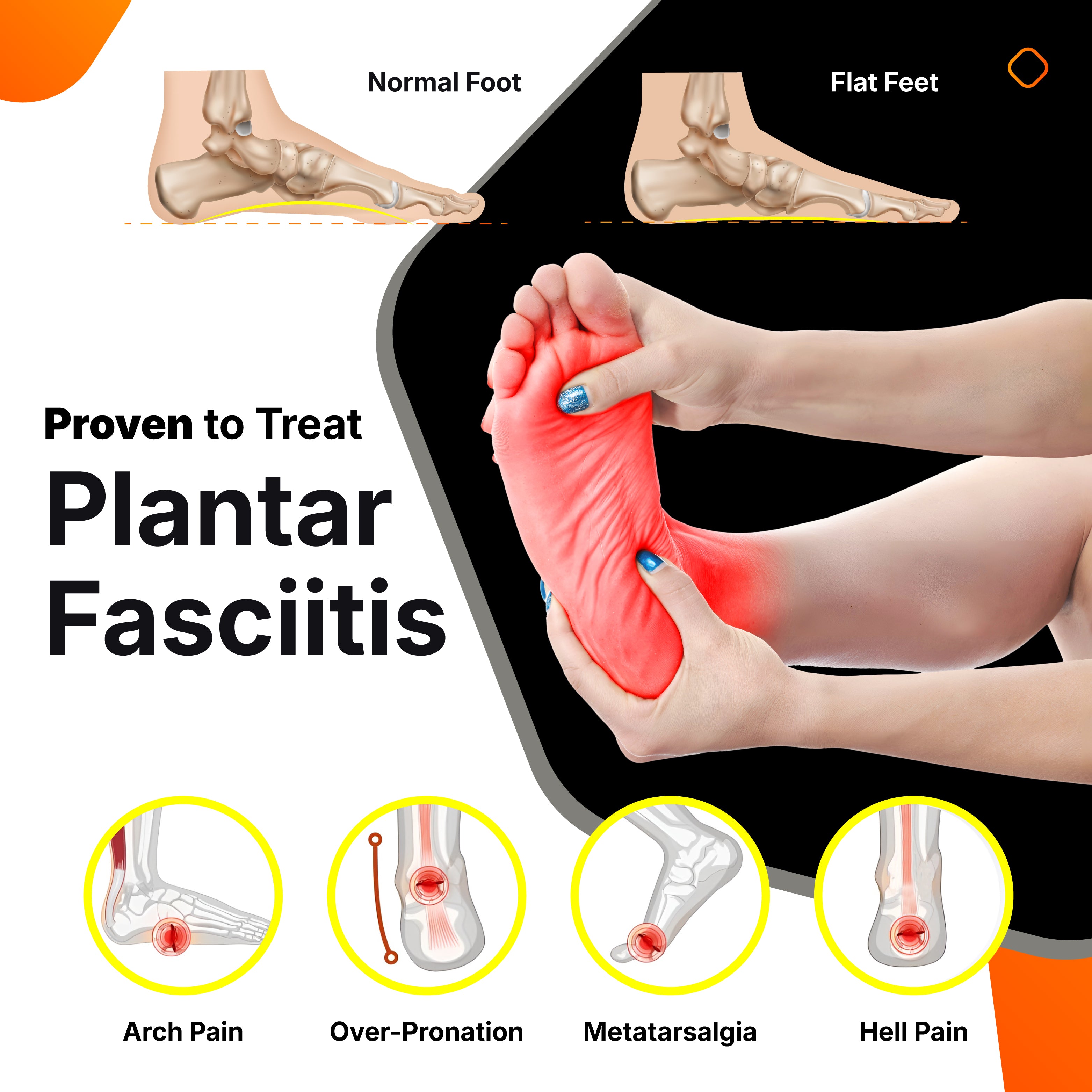 Arch support carbon fiber insoles designed to relieve plantar fasciitis, overpronation, metatarsalgia, arch pain, and heel pain. Corrects foot alignment, reduces strain, and provides all-day comfort for flat feet and high arches.
