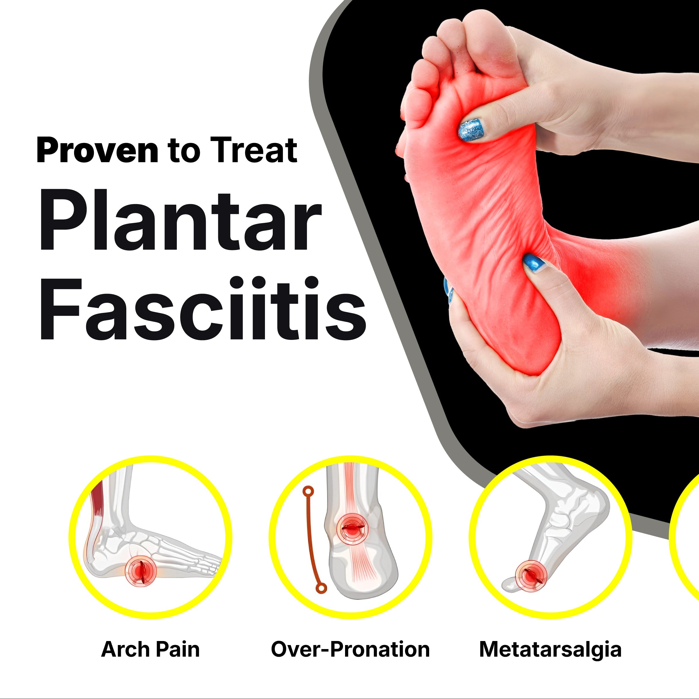 Arch support carbon fiber insoles designed to relieve plantar fasciitis, overpronation, metatarsalgia, arch pain, and heel pain. Corrects foot alignment, reduces strain, and provides all-day comfort for flat feet and high arches.